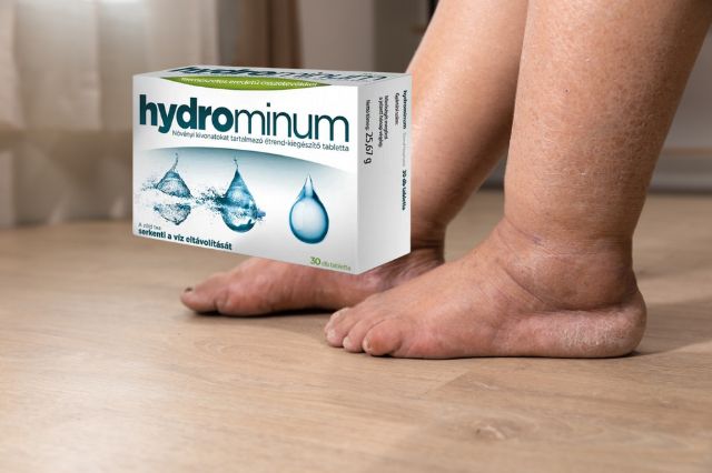 hydrominum-velemeny